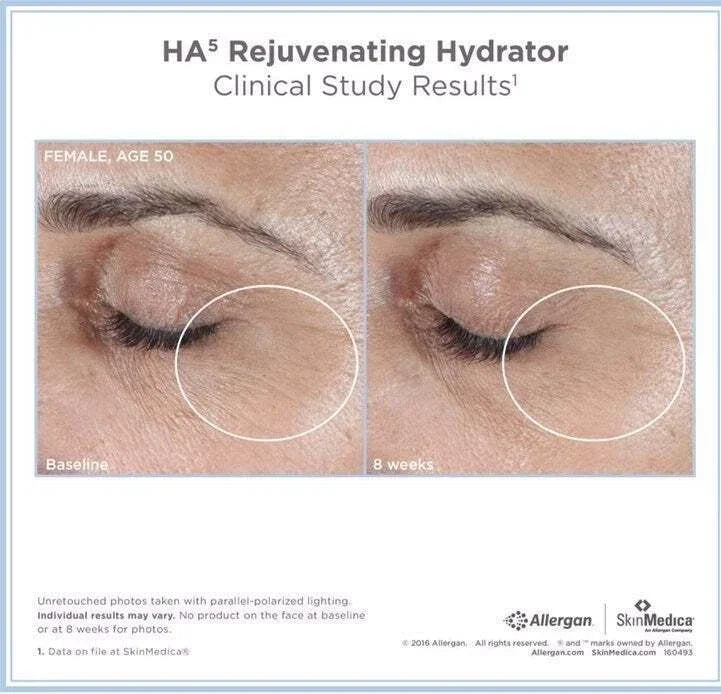 SkinMedica HA5 Rejuvenating Hydrator – 2 oz | Hyaluronic Acid Moisturizer | Brand New Sealed